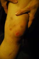 KMO_9932